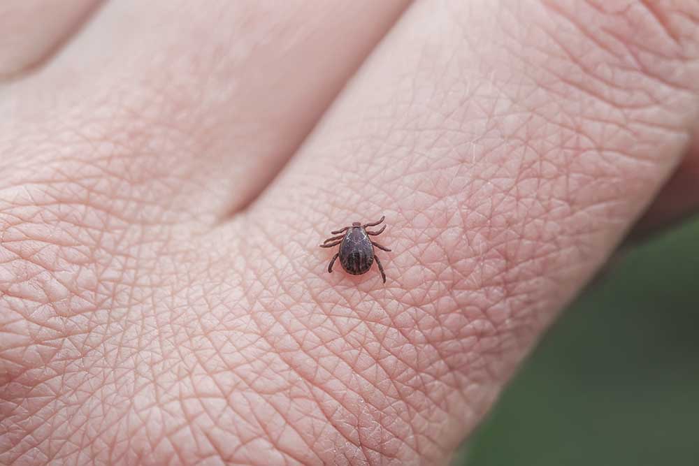 How to know if you have a tick?